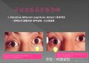 통합신경과학 - 시각계 17페이지