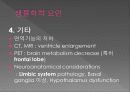 Major depressive disorder의 개요, 원인, 증상 20페이지