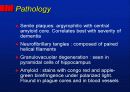 Alzheimer’s disease 18페이지