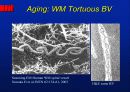 Alzheimer’s disease 23페이지