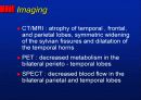 Alzheimer’s disease 35페이지