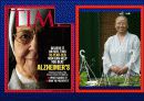 Alzheimer’s disease 53페이지
