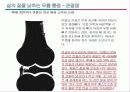 관절염 환자의 운동론 4페이지