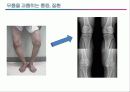 관절염 환자의 운동론 14페이지