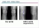 관절염 환자의 운동론 21페이지