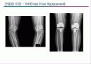 관절염 환자의 운동론 27페이지