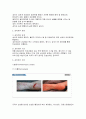 상처간호 - 상처의 정의, 치유과정, 기본 원칙, 사정과 기록, 욕창 간호 관리 4페이지