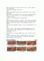 상처간호 - 상처의 정의, 치유과정, 기본 원칙, 사정과 기록, 욕창 간호 관리 8페이지