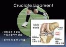 십자인대 손상원인과 예방 및 재활방법 5페이지