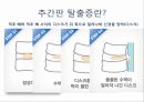 허리디스크_PPT 4페이지