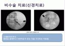 허리디스크_PPT 9페이지