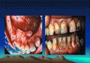 School Health 5페이지
