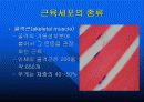 근수축 관련 11페이지