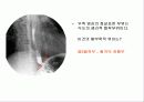 투시조영 리피트 (촬영) 7페이지