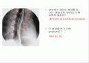 투시조영 리피트 (촬영) 8페이지