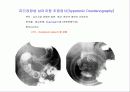 투시조영 리피트 (촬영) 16페이지