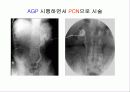투시조영 리피트 (촬영) 57페이지