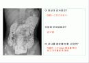 투시조영 리피트 (촬영) 79페이지