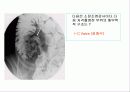 투시조영 리피트 (촬영) 80페이지
