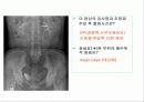 투시조영 리피트 (촬영) 84페이지