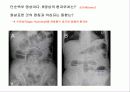 투시조영 리피트 (촬영) 86페이지