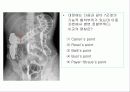 투시조영 리피트 (촬영) 89페이지