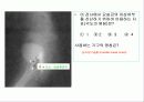 투시조영 리피트 (촬영) 93페이지