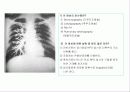 투시조영 리피트 (촬영) 99페이지
