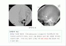중재적 시술 28페이지
