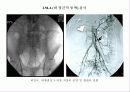 중재적 시술 37페이지