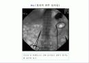 중재적 시술 53페이지