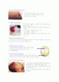 신생아의 특징 2페이지
