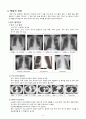 폐암 (Lung cancer) 문헌고찰 9페이지