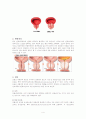 전립선비대증과 경요도전립선 수술. 후 간호 4페이지