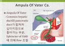 GI bleeding conference 19페이지