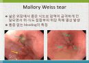 GI bleeding conference 21페이지