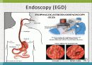 GI bleeding conference 26페이지
