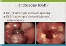 GI bleeding conference 28페이지