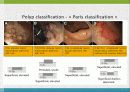 GI bleeding conference 31페이지