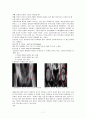 대퇴골 골절1[1] 7페이지