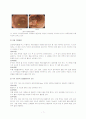 total gastrectomy case study 8페이지