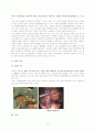 total gastrectomy case study 11페이지