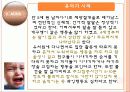 아동 및 청소년기 정신병리의 정의 및 중요성, 유형, 분류 및 치료방안 [A+ 평가 레포트] 28페이지