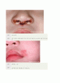 제5장 유아의 건강관리 24페이지