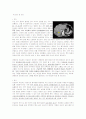 간농양(liver abscess)환자 간호사례 연구 4페이지
