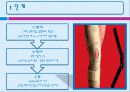 후방십자인대 및 내측측부인대 손상 31페이지
