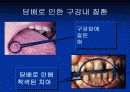 금연 교육 - 금연 나를 소중하게 생각하는 시작! 7페이지