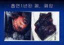 금연 교육 - 금연 나를 소중하게 생각하는 시작! 8페이지