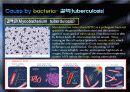 [미생물 생태학] communicable diseases by contact with animals 18페이지