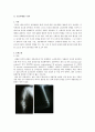 OS case Humerus shaft fracture 2페이지